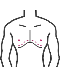 Breast swelling in men